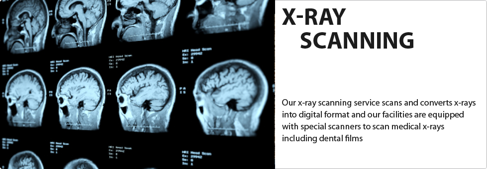 xray